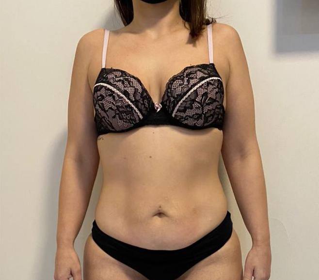 Depois do tratamento