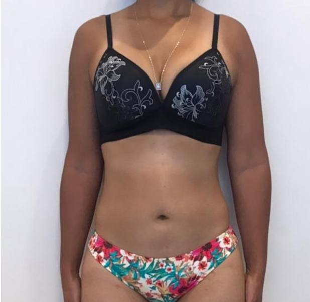 Depois do tratamento